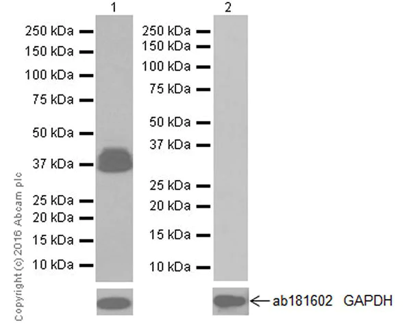 Western blot - Anti-GFAP antibody [EPR19996] - Astrocyte Marker (AB207165)