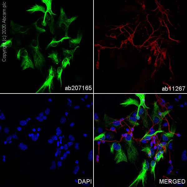 Immunocytochemistry/ Immunofluorescence - Anti-GFAP antibody [EPR19996] - BSA and Azide free (AB223127)