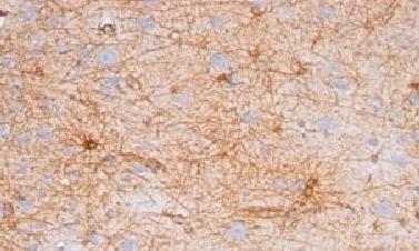 Immunohistochemistry (Formalin/PFA-fixed paraffin-embedded sections) - Anti-GFAP antibody [GA-5] - BSA and Azide free (AB212398)