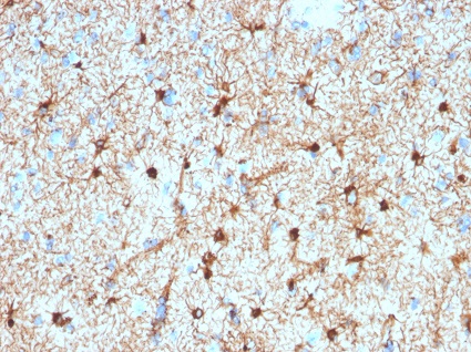 Immunohistochemistry (Formalin/PFA-fixed paraffin-embedded sections) - Anti-GFAP antibody [GFAP/20762076] - BSA and Azide free (AB237844)