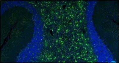 Immunohistochemistry (Formalin/PFA-fixed paraffin-embedded sections) - Anti-GFAP antibody [N206A/8] - Chicken IgY (Chimeric) (AB325664)