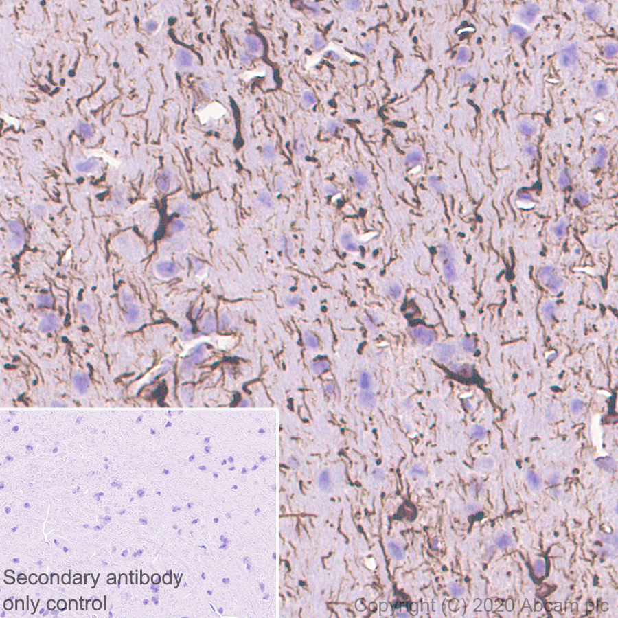 Immunohistochemistry (Formalin/PFA-fixed paraffin-embedded sections) - Anti-GFAP antibody [RM1003] (ab278054), expandable thumbnail