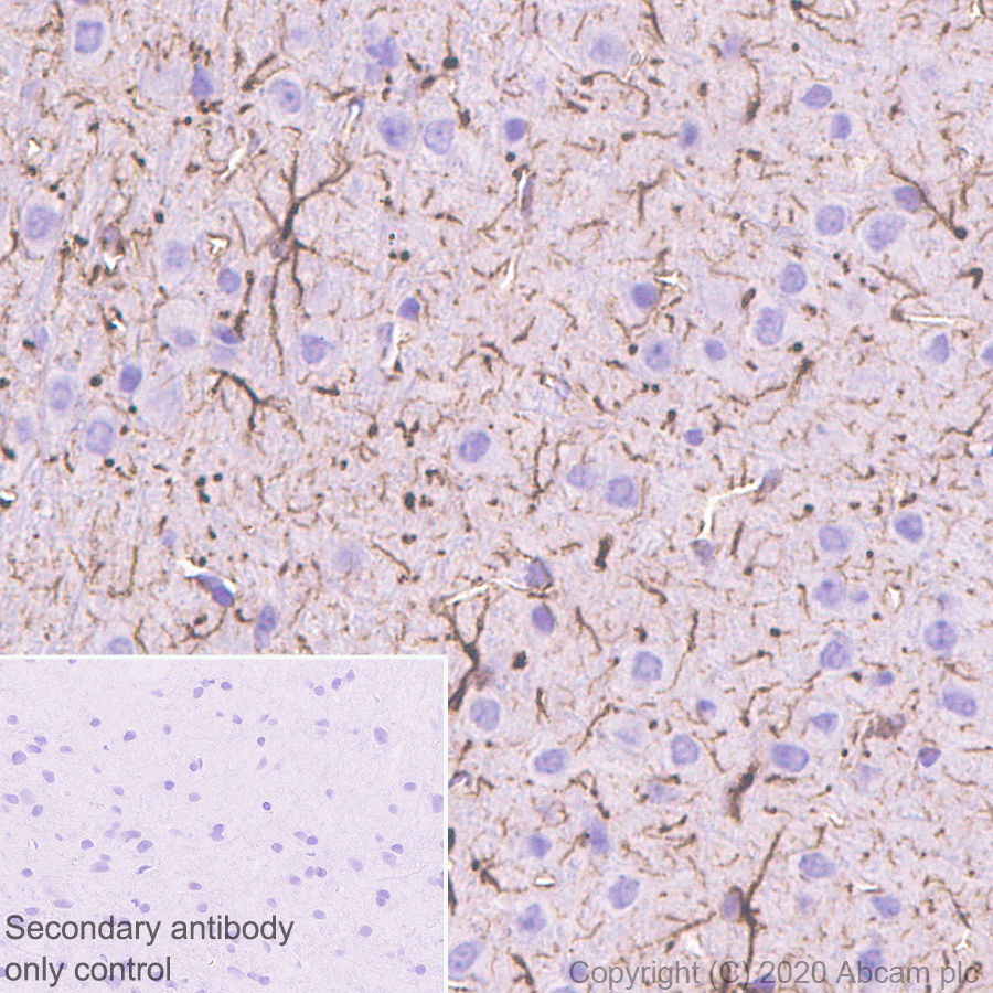 Immunohistochemistry (Formalin/PFA-fixed paraffin-embedded sections) - Anti-GFAP antibody [RM1003] (ab278054), expandable thumbnail