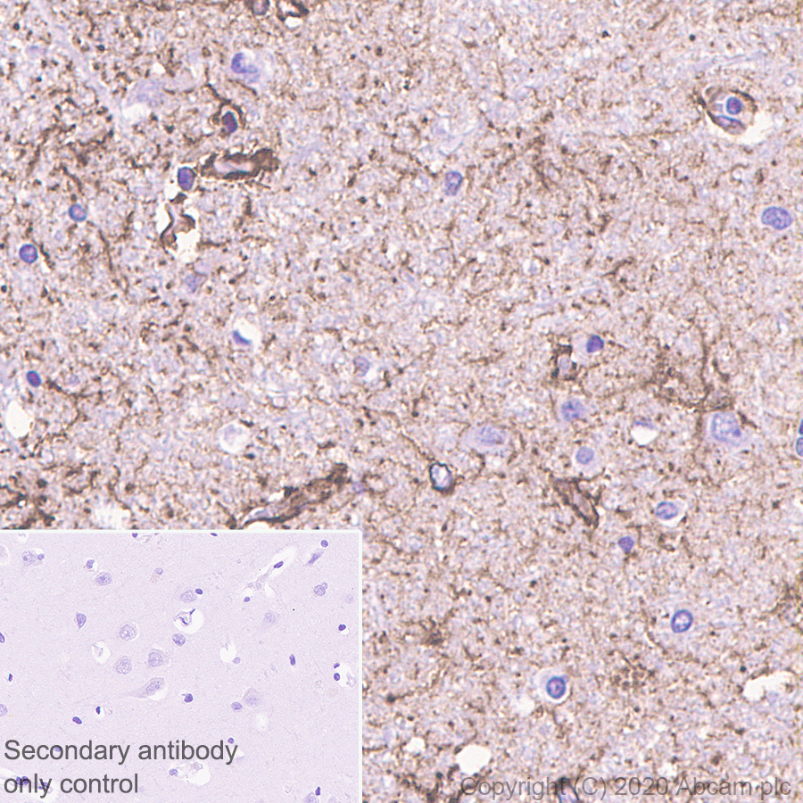 Immunohistochemistry (Formalin/PFA-fixed paraffin-embedded sections) - Anti-GFAP antibody [RM1003] (AB278054), expandable thumbnail