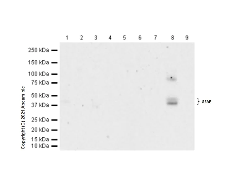 Western blot - Anti-GFAP antibody [RM1003] - Astrocyte Marker (AB278054)