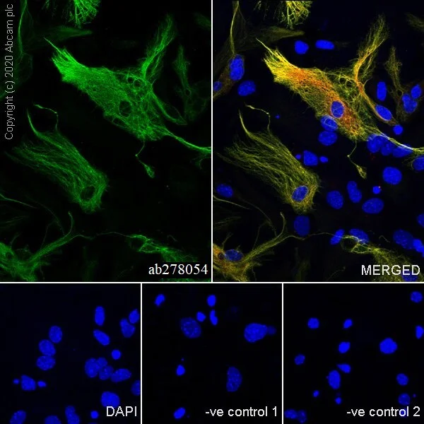 Immunocytochemistry/ Immunofluorescence - Anti-GFAP antibody [RM1003] - BSA and Azide free (AB283862)