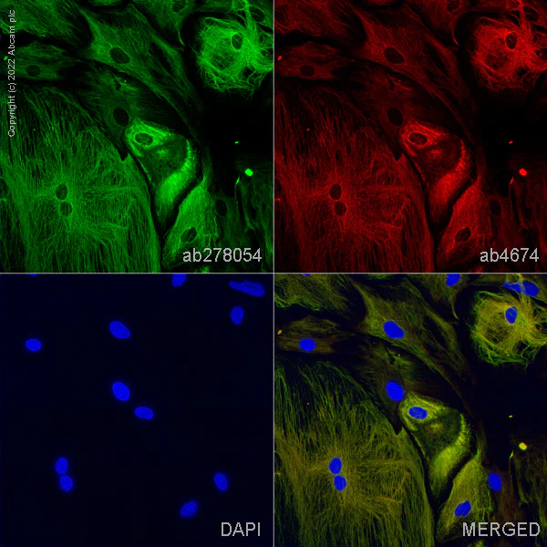Immunocytochemistry/ Immunofluorescence - Anti-GFAP antibody [RM1003] - BSA and Azide free (AB283862)