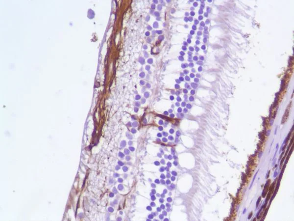 Immunohistochemistry (Formalin/PFA-fixed paraffin-embedded sections) - Anti-GFAP antibody [SP78] - C-terminal - Astrocyte Marker (AB227641)