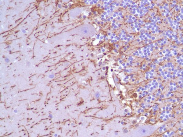 Immunohistochemistry (Formalin/PFA-fixed paraffin-embedded sections) - Anti-GFAP antibody [SP78] - C-terminal (AB227641), expandable thumbnail
