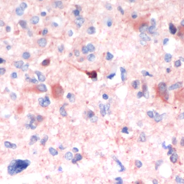 Immunohistochemistry (Formalin/PFA-fixed paraffin-embedded sections) - Anti-GFAP antibody [SP78] - C-terminal (AB227641), expandable thumbnail