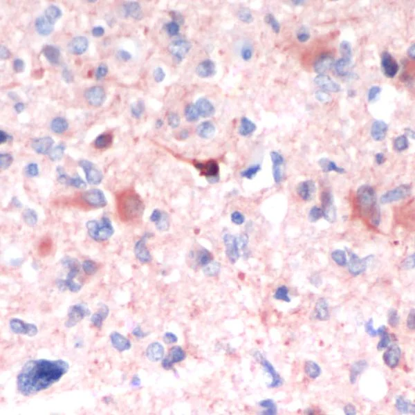 Immunohistochemistry (Formalin/PFA-fixed paraffin-embedded sections) - Anti-GFAP antibody [SP78] - C-terminal - Astrocyte Marker (AB227641)