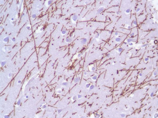 Immunohistochemistry (Formalin/PFA-fixed paraffin-embedded sections) - Anti-GFAP antibody [SP78] - C-terminal (AB227641), expandable thumbnail