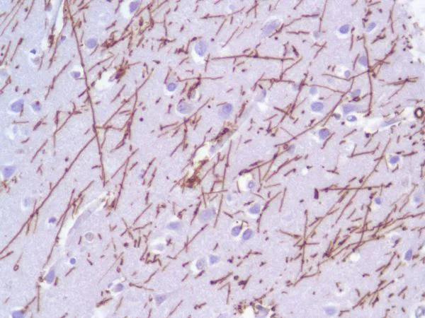 Immunohistochemistry (Formalin/PFA-fixed paraffin-embedded sections) - Anti-GFAP antibody [SP78] - C-terminal - Astrocyte Marker (AB227641)