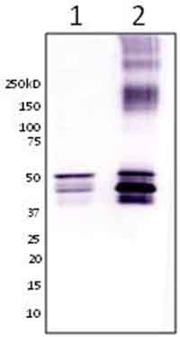 Immunoprecipitation - Anti-GFAP antibody [ZRF-1] - Astrocyte Marker (AB154474), expandable thumbnail