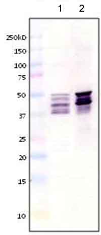 Western blot - Anti-GFAP antibody [ZRF-1] - Astrocyte Marker (AB154474), expandable thumbnail