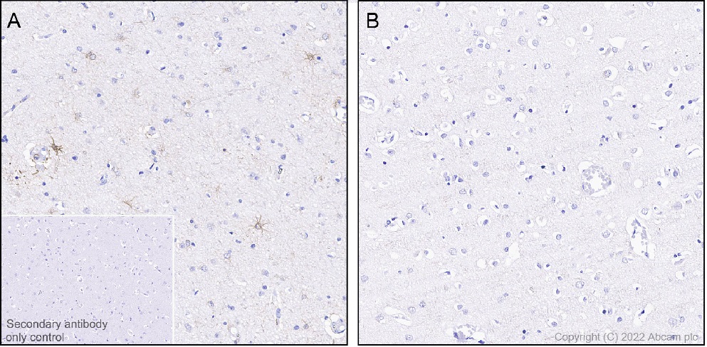 Immunohistochemistry (Formalin/PFA-fixed paraffin-embedded sections) - Anti-GFAP (phospho S13) antibody [EPR25281-65] (AB303560)