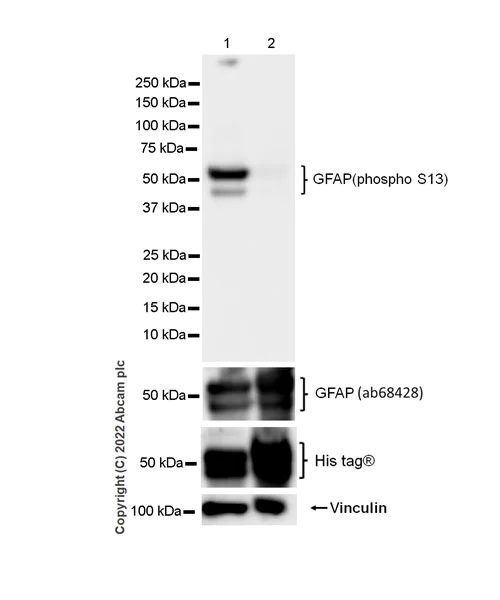 Western blot - Anti-GFAP (phospho S13) antibody [EPR25281-65] (AB303560)