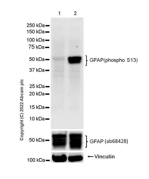 Western blot - Anti-GFAP (phospho S13) antibody [EPR25281-65] (AB303560)