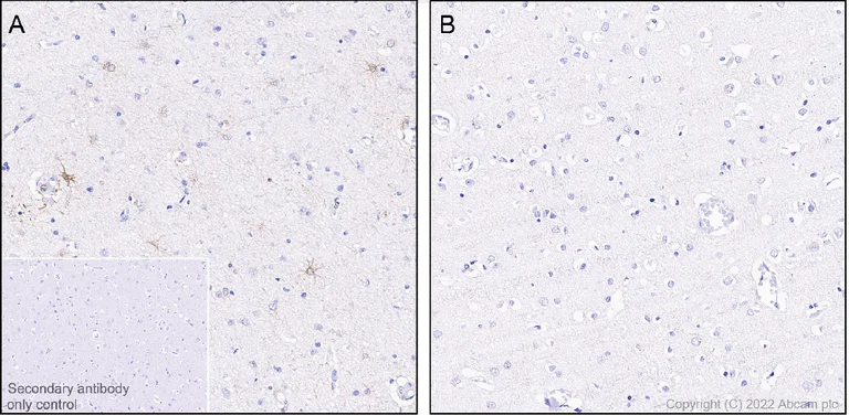 Immunohistochemistry (Formalin/PFA-fixed paraffin-embedded sections) - Anti-GFAP (phospho S13) antibody [EPR25281-65] - BSA and Azide free (AB303561)