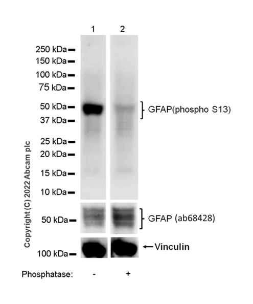 Western blot - Anti-GFAP (phospho S13) antibody [EPR25281-65] - BSA and Azide free (AB303561)