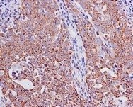 Immunohistochemistry (Formalin/PFA-fixed paraffin-embedded sections) - Anti-GFM1 antibody [EPR12263] - BSA and Azide free (AB249664), expandable thumbnail