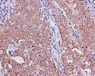 Immunohistochemistry (Formalin/PFA-fixed paraffin-embedded sections) - Anti-GFM1 antibody [EPR12263] - BSA and Azide free (AB249664)