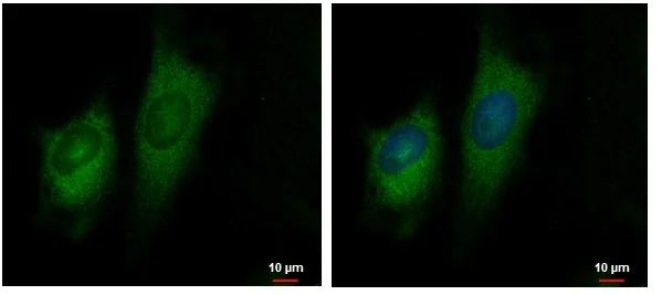 Immunocytochemistry/ Immunofluorescence - Anti-GFM2 antibody (AB229463)