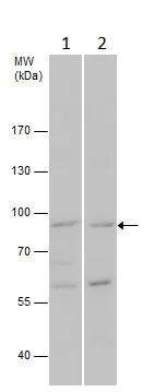 Western blot - Anti-GFM2 antibody (AB229463)