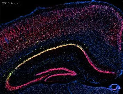 Immunohistochemistry - Free Floating - Anti-GFP antibody (AB290)