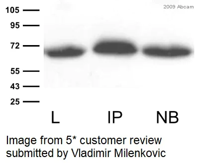 Immunoprecipitation - Anti-GFP antibody (AB290)
