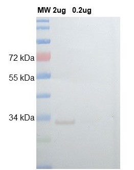 Western blot - Anti-GFP antibody (AB307275), expandable thumbnail