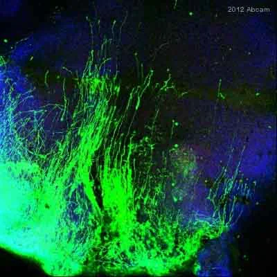 IHC - Wholemount - Anti-GFP antibody (AB5450)