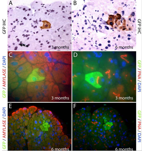 Immunohistochemistry (Formalin/PFA-fixed paraffin-embedded sections) - Anti-GFP antibody (AB5450)