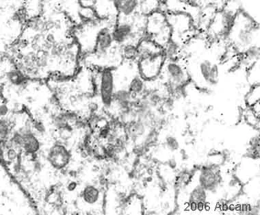 Electron Microscopy - Anti-GFP antibody (AB6556)