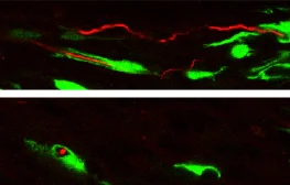 Immunocytochemistry/ Immunofluorescence - Anti-GFP antibody (AB6556)