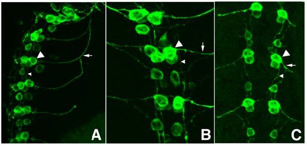 IHC - Wholemount - Anti-GFP antibody (ab6673), expandable thumbnail