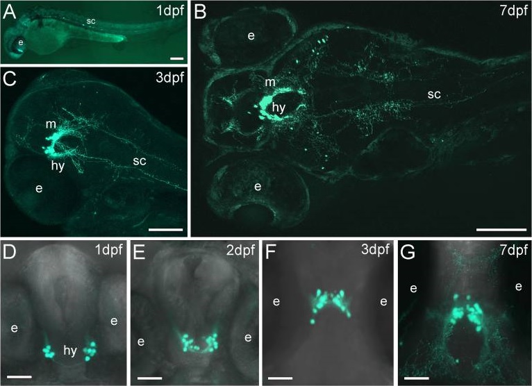 Immunohistochemistry - Free Floating - Anti-GFP antibody (AB6673), expandable thumbnail