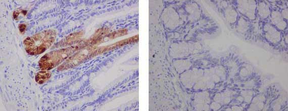 Immunohistochemistry (Formalin/PFA-fixed paraffin-embedded sections) - Anti-GFP antibody [EPR14104-89] - BSA and Azide free (AB236117), expandable thumbnail