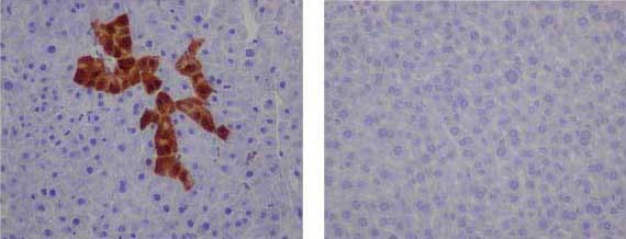 Immunohistochemistry (Formalin/PFA-fixed paraffin-embedded sections) - Anti-GFP antibody [EPR14104-89] - BSA and Azide free (AB236117), expandable thumbnail