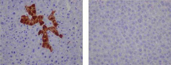 Immunohistochemistry (Formalin/PFA-fixed paraffin-embedded sections) - Anti-GFP antibody [EPR14104-89] - BSA and Azide free (AB236117)