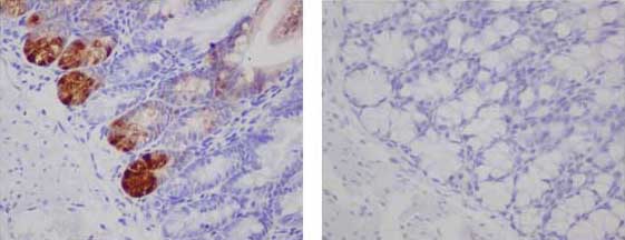 Immunohistochemistry (Formalin/PFA-fixed paraffin-embedded sections) - Anti-GFP antibody [EPR14104] (AB183734), expandable thumbnail
