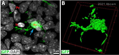 Immunohistochemistry (Formalin/PFA-fixed paraffin-embedded sections) - Anti-GFP antibody [EPR14104] (ab183734), expandable thumbnail