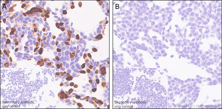 Immunohistochemistry (Formalin/PFA-fixed paraffin-embedded sections) - Anti-GFP antibody [EPR14104] - Chicken IgY (Chimeric) (AB300643)