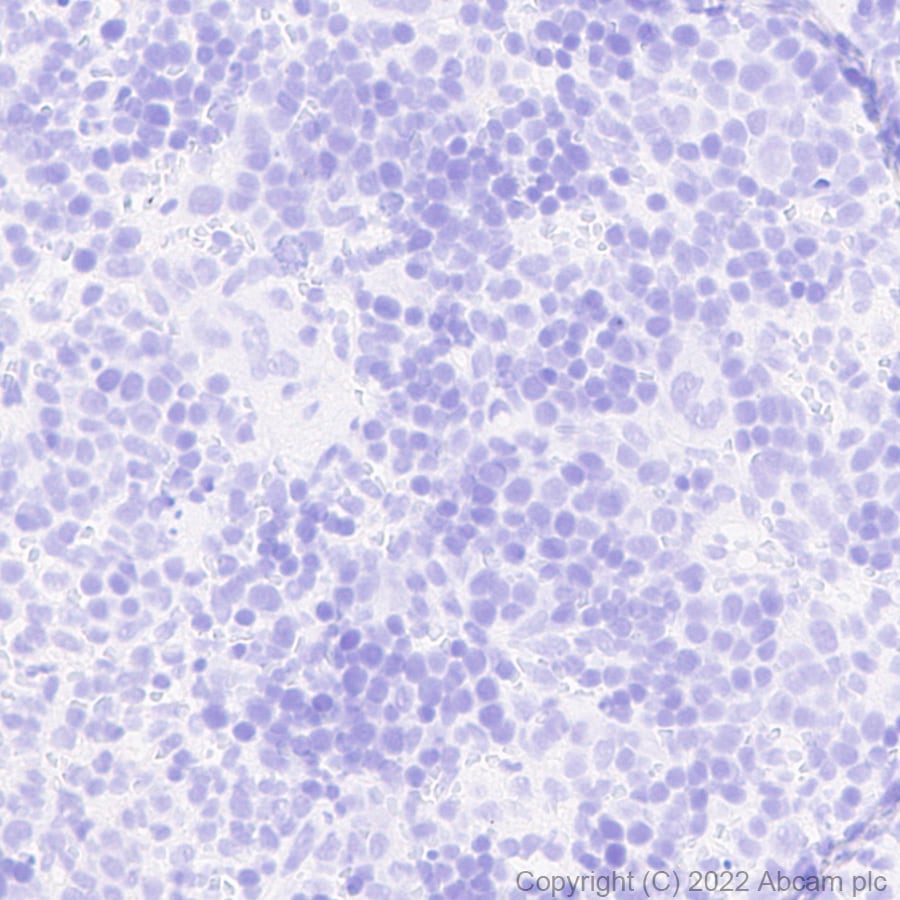 Immunohistochemistry (Formalin/PFA-fixed paraffin-embedded sections) - Anti-GFP antibody [EPR14104] - Chicken IgY (Chimeric) (ab300643), expandable thumbnail