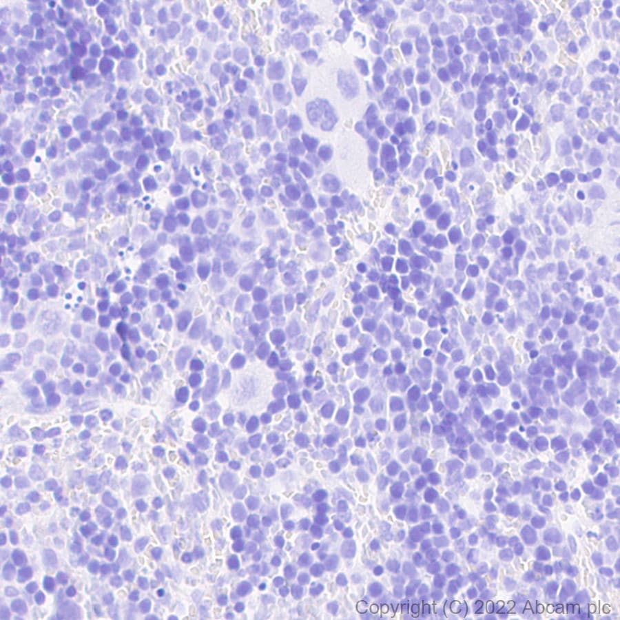 Immunohistochemistry (Formalin/PFA-fixed paraffin-embedded sections) - Anti-GFP antibody [EPR14104] - Chicken IgY (Chimeric) - BSA and Azide free (AB300644), expandable thumbnail