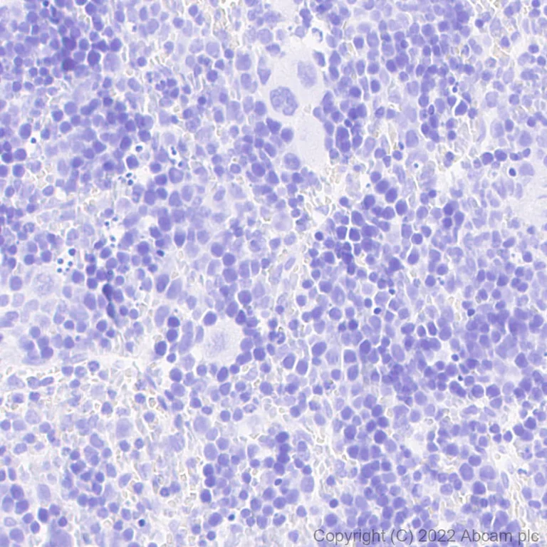 Immunohistochemistry (Formalin/PFA-fixed paraffin-embedded sections) - Anti-GFP antibody [EPR14104] - Chicken IgY (Chimeric) - BSA and Azide free (AB300644)