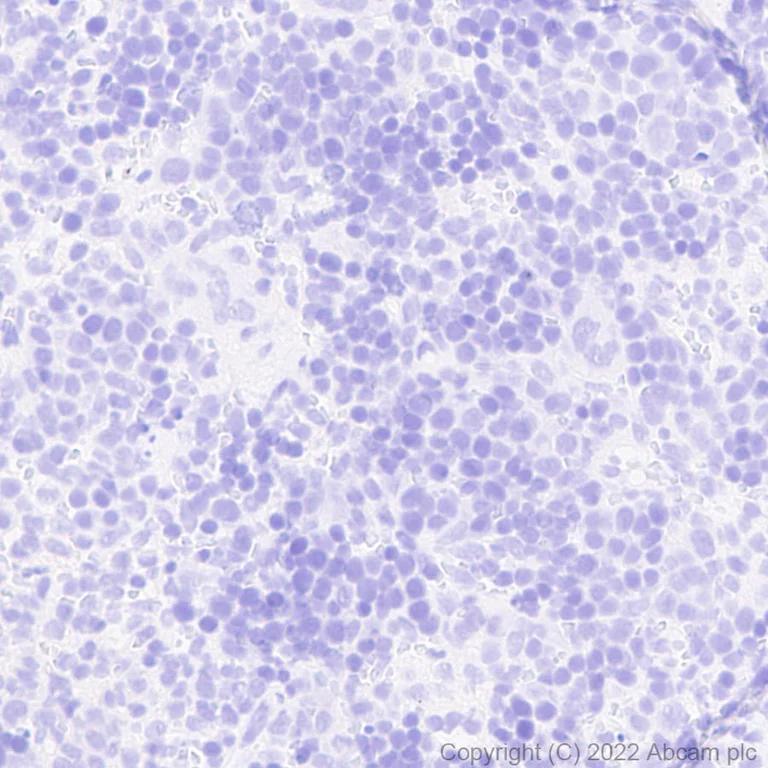 Immunohistochemistry (Formalin/PFA-fixed paraffin-embedded sections) - Anti-GFP antibody [EPR14104] - Chicken IgY (Chimeric) - BSA and Azide free (AB300644)