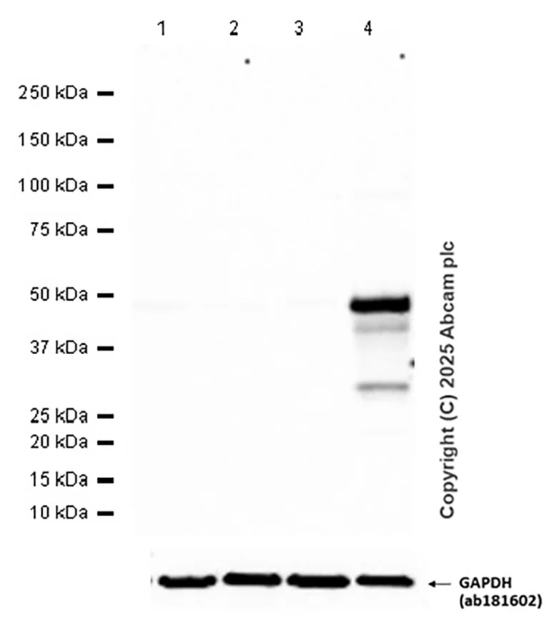 Western blot - Anti-GFP antibody [EPR14104] - Chicken IgY (Chimeric) - BSA and Azide free (AB300644)