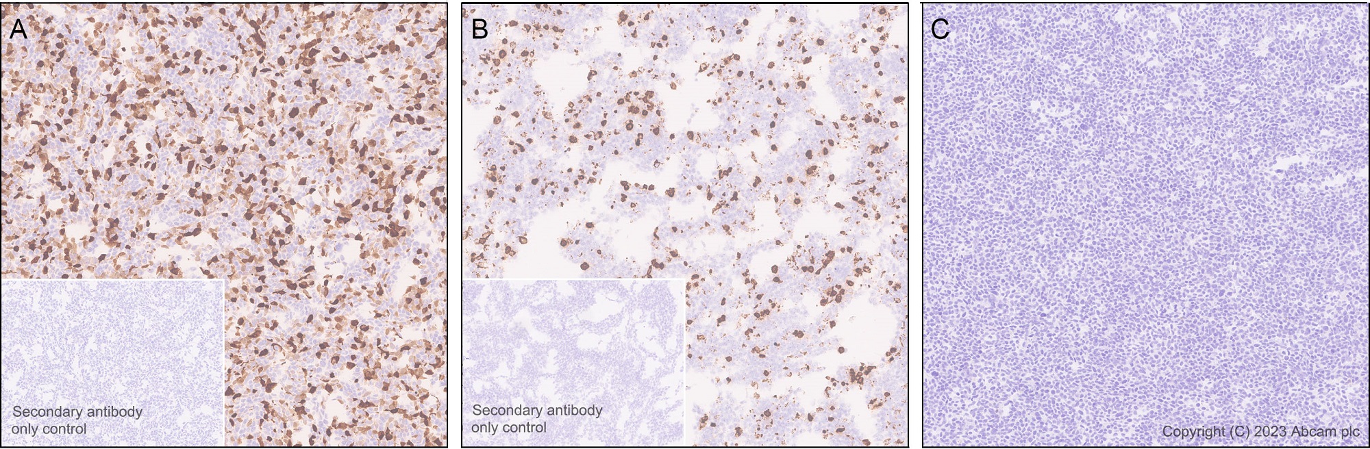 Immunohistochemistry (Formalin/PFA-fixed paraffin-embedded sections) - Anti-GFP antibody [EPR28018-38] (ab314656), expandable thumbnail