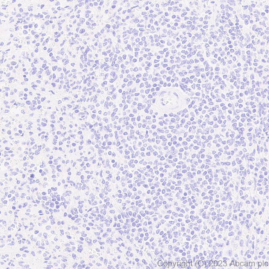 Immunohistochemistry (Formalin/PFA-fixed paraffin-embedded sections) - Anti-GFP antibody [EPR28018-38] (ab314656), expandable thumbnail